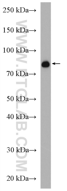 Western Blot (WB) analysis of SKOV-3 cells using eRF3a/GSPT1 Polyclonal antibody (28130-1-AP)