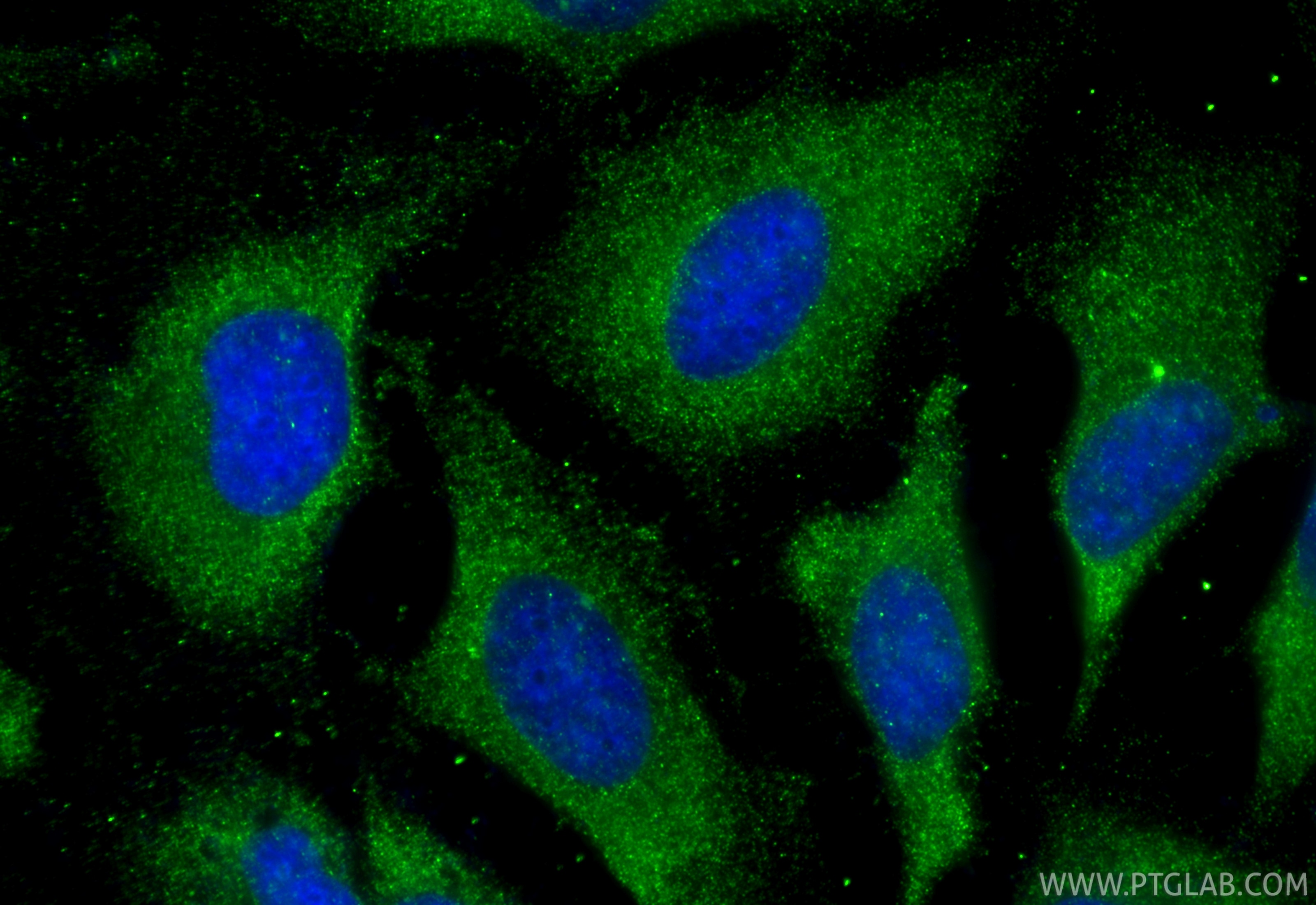 Immunofluorescent analysis of (-20°C Ethanol) fixed HeLa cells using eRF3a/GSPT1 antibody (68217-1-Ig, Clone: 2A3H6 ) at dilution of 1:1000 and CoraLite®488-Conjugated Goat Anti-Mouse IgG(H+L) (SA00013-1). Immunofluorescence (IF) / fluorescent staining of HeLa cells using eRF3a/GSPT1 Monoclonal antibody (68217-1-Ig)
