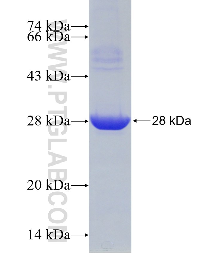 GSPT1 fusion protein Ag27986 SDS-PAGE