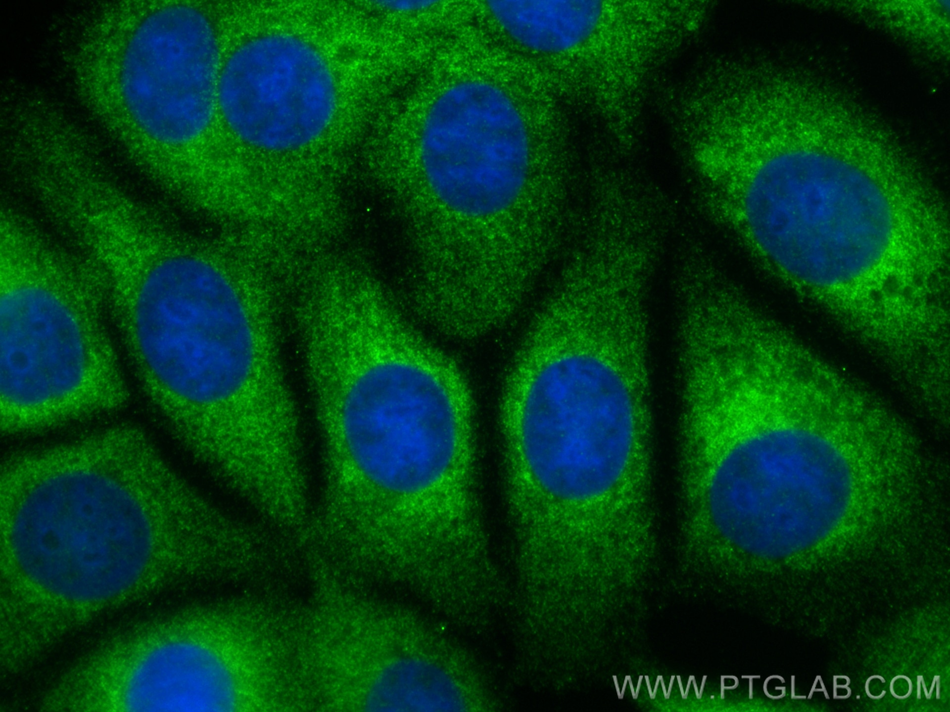 Immunofluorescence (IF) / fluorescent staining of MCF-7 cells using GSPT2 Polyclonal antibody (12989-1-AP)