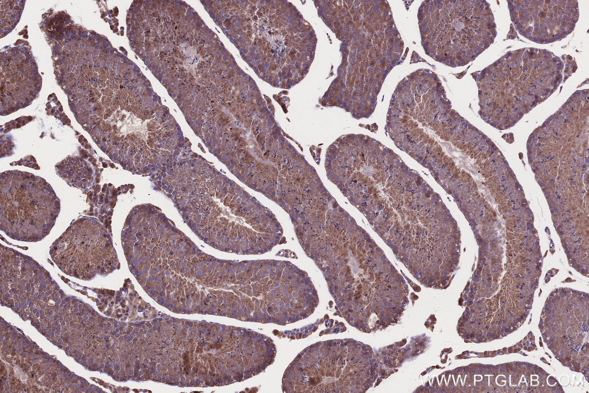 Immunohistochemistry (IHC) staining of mouse testis tissue using GSPT2 Polyclonal antibody (12989-1-AP)