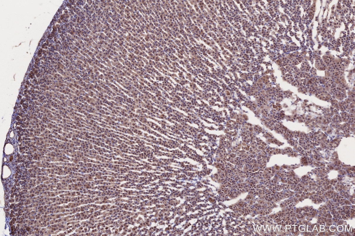 Immunohistochemistry (IHC) staining of rat adrenal gland tissue using GSPT2 Polyclonal antibody (12989-1-AP)