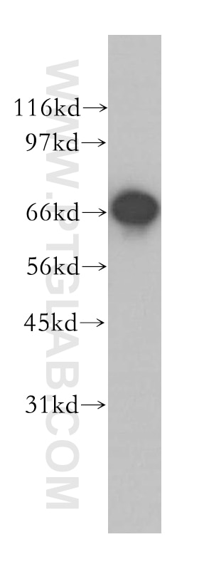 Western Blot (WB) analysis of MCF-7 cells using GSPT2 Polyclonal antibody (12989-1-AP)