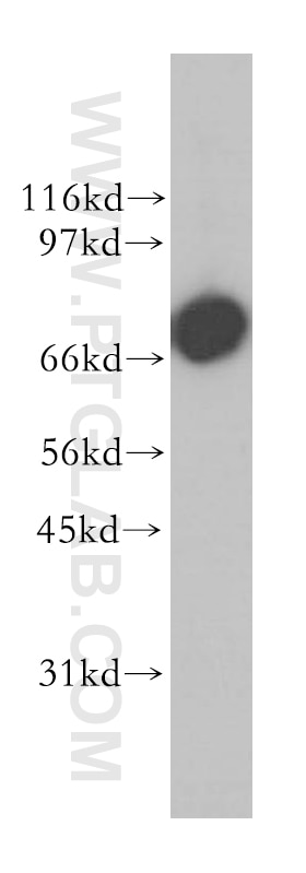 Western Blot (WB) analysis of NIH/3T3 cells using GSPT2 Polyclonal antibody (12989-1-AP)