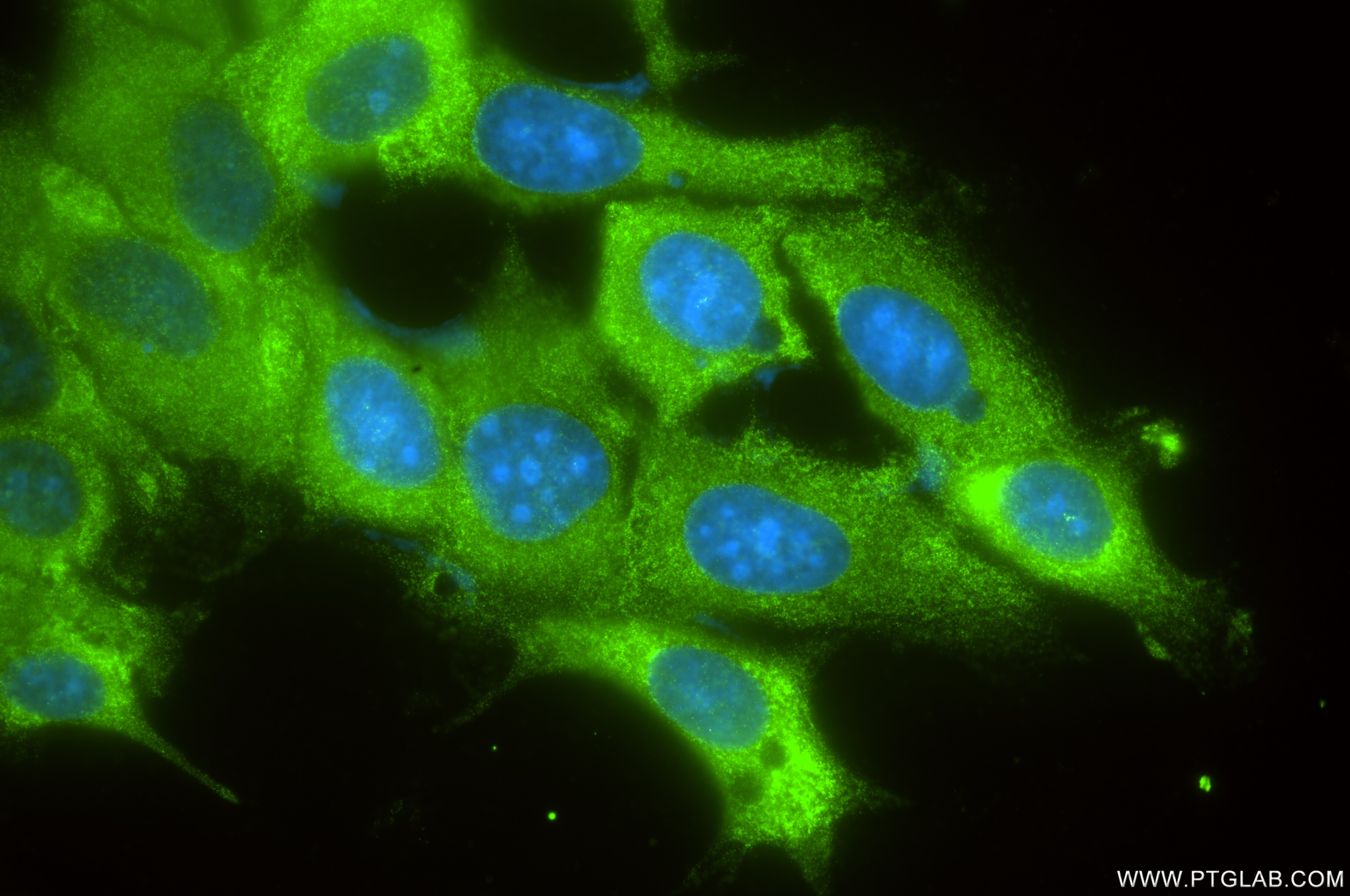 Immunofluorescent analysis of (-20°C Ethanol) fixed MCF-7 cells using GSPT2 antibody (86508-3-RR, Clone: 251224C9 ) at dilution of 1:500 and CoraLite®488-Conjugated Goat Anti-Rabbit IgG(H+L) (SA00013-2). Immunofluorescence (IF) / fluorescent staining of MCF-7 cells using GSPT2 Recombinant antibody (86508-3-RR)