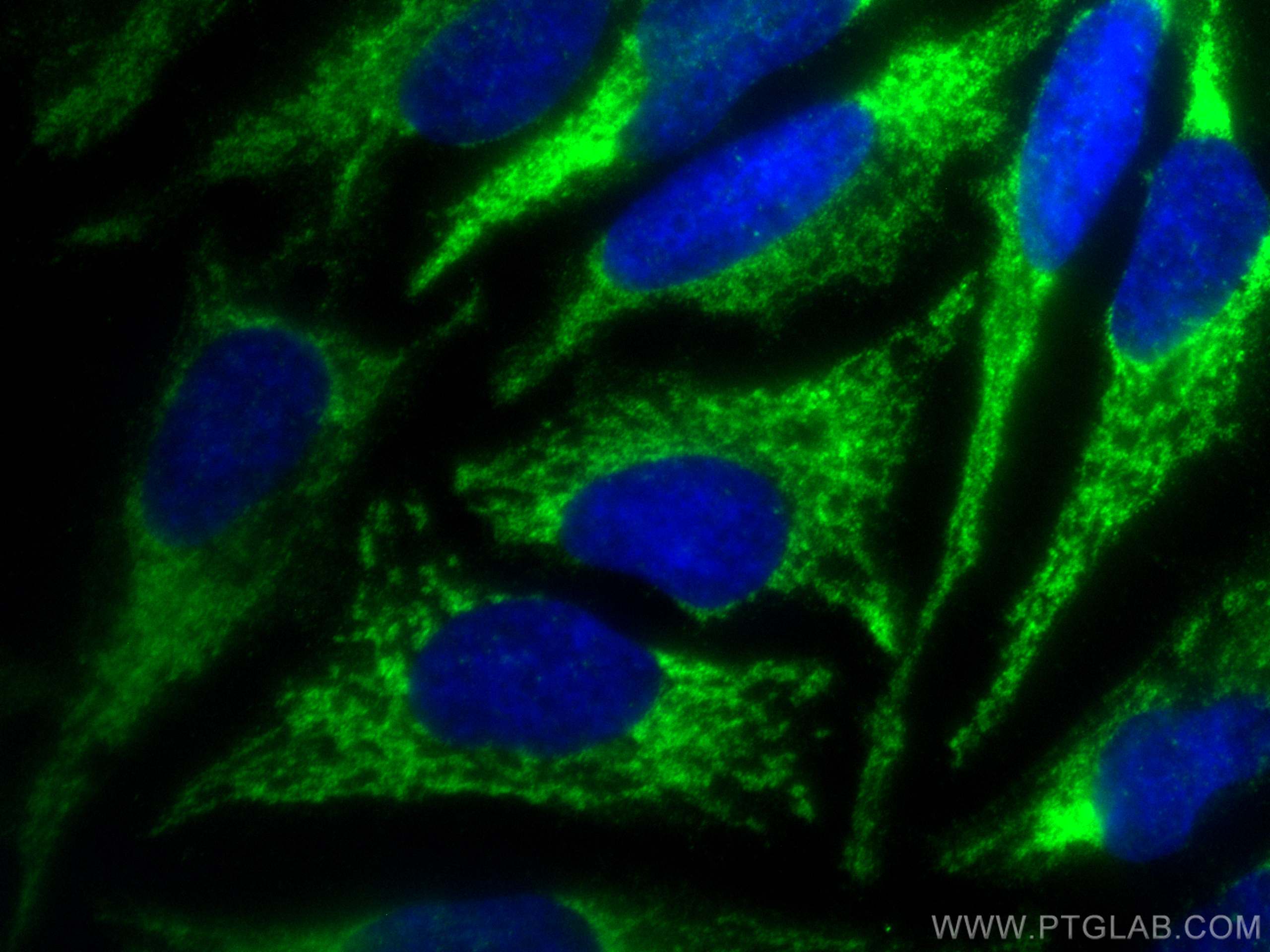 Immunofluorescence (IF) / fluorescent staining of HeLa cells using GSR Polyclonal antibody (18257-1-AP)