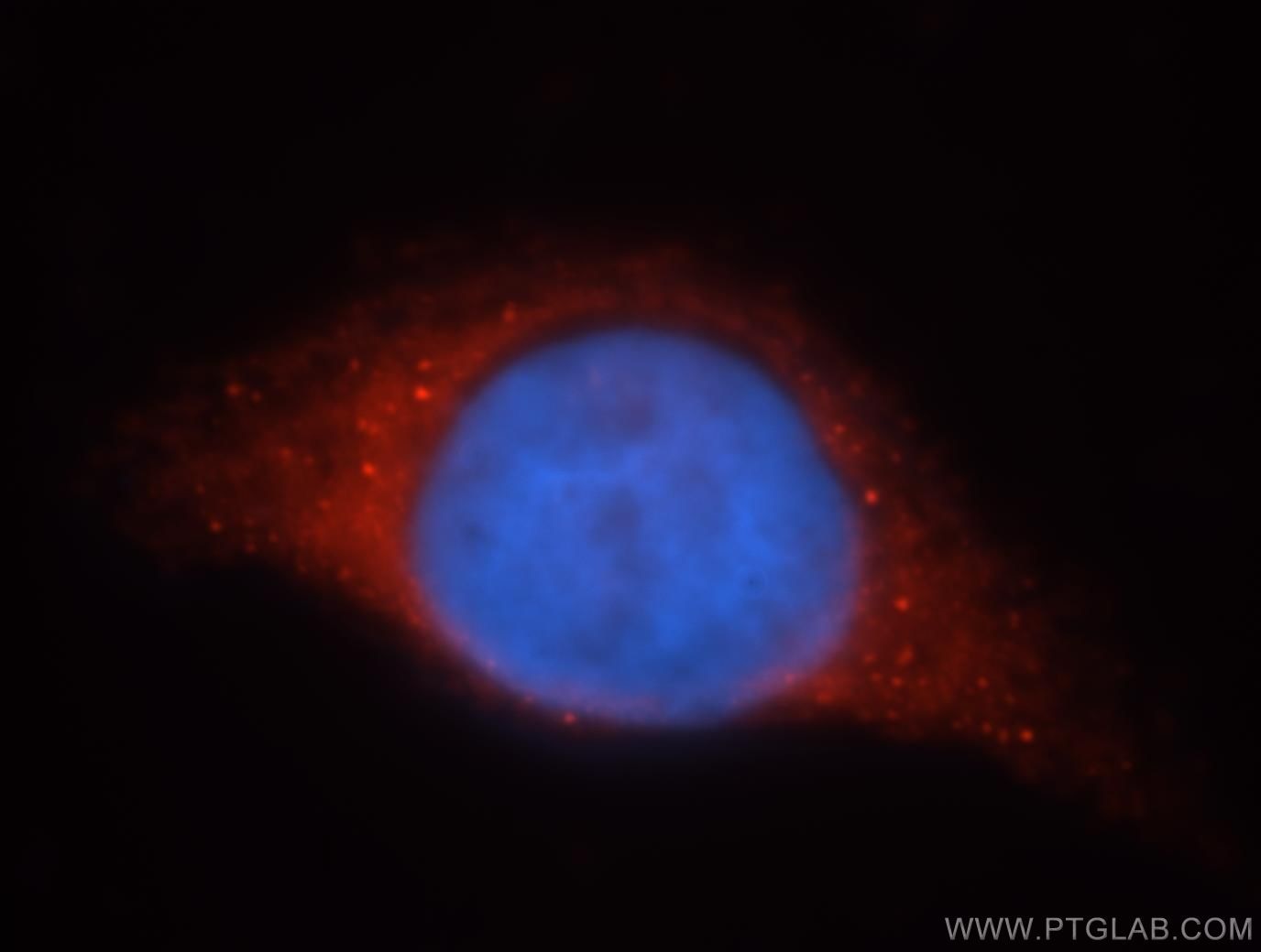 Immunofluorescence (IF) / fluorescent staining of MCF-7 cells using GSR Polyclonal antibody (18257-1-AP)