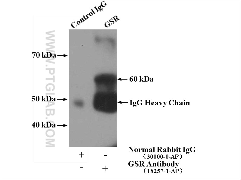 Immunoprecipitation (IP) experiment of HeLa cells using GSR Polyclonal antibody (18257-1-AP)