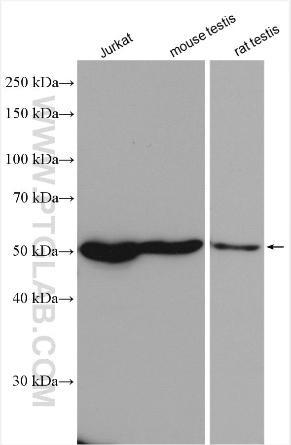 Western Blot (WB) analysis of various lysates using GSR Polyclonal antibody (18257-1-AP)