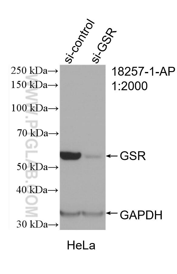 Western Blot (WB) analysis of HeLa cells using GSR Polyclonal antibody (18257-1-AP)