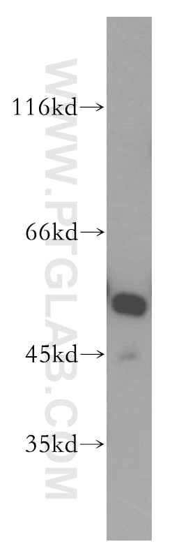 Western Blot (WB) analysis of HeLa cells using GSR Polyclonal antibody (18257-1-AP)