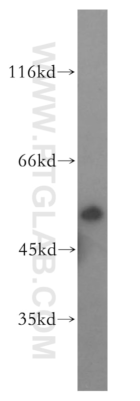 Western Blot (WB) analysis of human placenta tissue using GSR Polyclonal antibody (18257-1-AP)