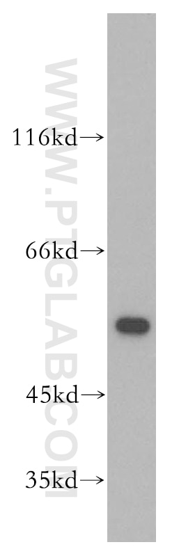 Western Blot (WB) analysis of Jurkat cells using GSR Polyclonal antibody (18257-1-AP)