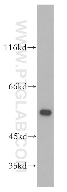 WB analysis of Jurkat using 18257-1-AP