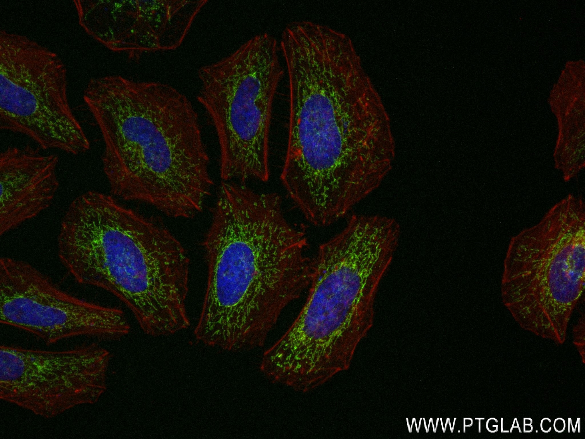 Immunofluorescence (IF) / fluorescent staining of HeLa cells using GSR Recombinant antibody (84480-2-RR)