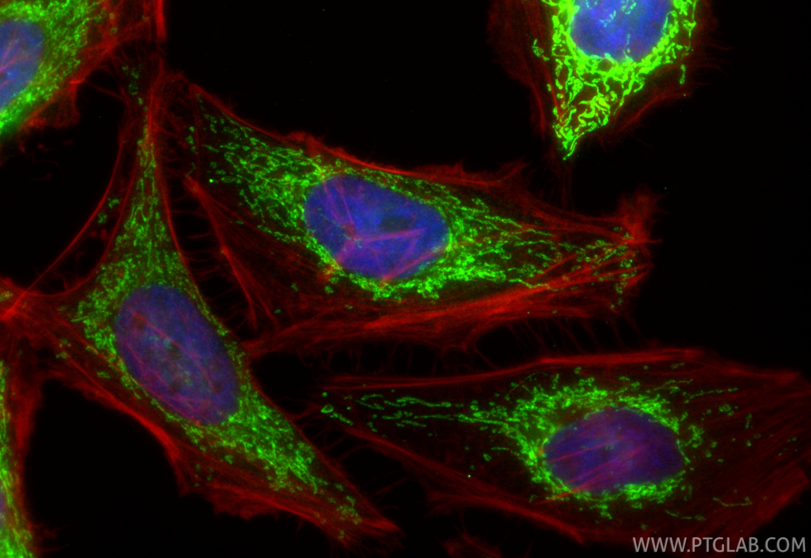 Immunofluorescent analysis of (4% PFA) fixed HeLa cells using CoraLite® Plus 488 GSR antibody (CL488-84480-2, Clone: 241934D2 ) at dilution of 1:200, CL594-Phalloidin (red). Immunofluorescence (IF) / fluorescent staining of HeLa cells using CoraLite® Plus 488-conjugated GSR Recombinant mono (CL488-84480-2)