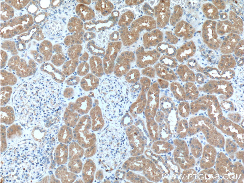 IHC staining of human kidney using 15712-1-AP