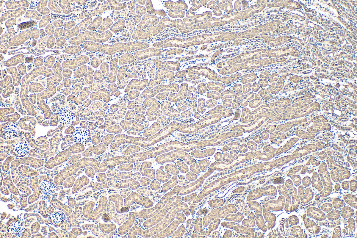Immunohistochemistry (IHC) staining of mouse kidney tissue using GSS Polyclonal antibody (15712-1-AP)