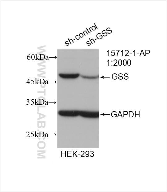 Western Blot (WB) analysis of HEK-293 cells using GSS Polyclonal antibody (15712-1-AP)