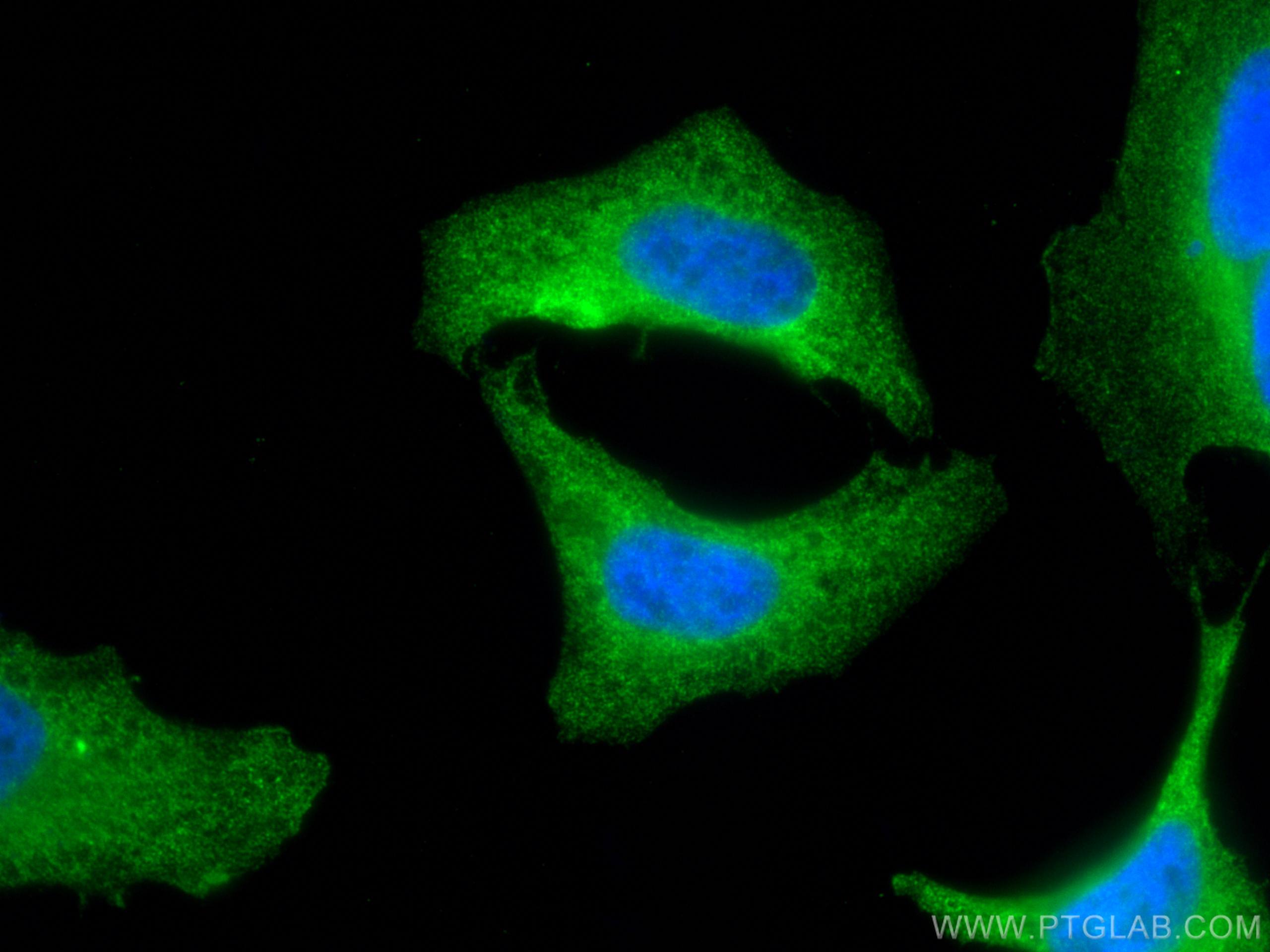Immunofluorescence (IF) / fluorescent staining of HeLa cells using GSS Monoclonal antibody (67598-1-Ig)