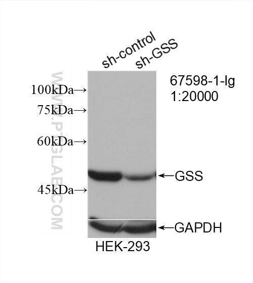 Western Blot (WB) analysis of HEK-293 cells using GSS Monoclonal antibody (67598-1-Ig)