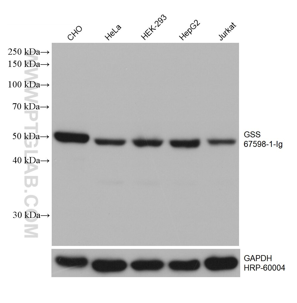 Western Blot (WB) analysis of various lysates using GSS Monoclonal antibody (67598-1-Ig)