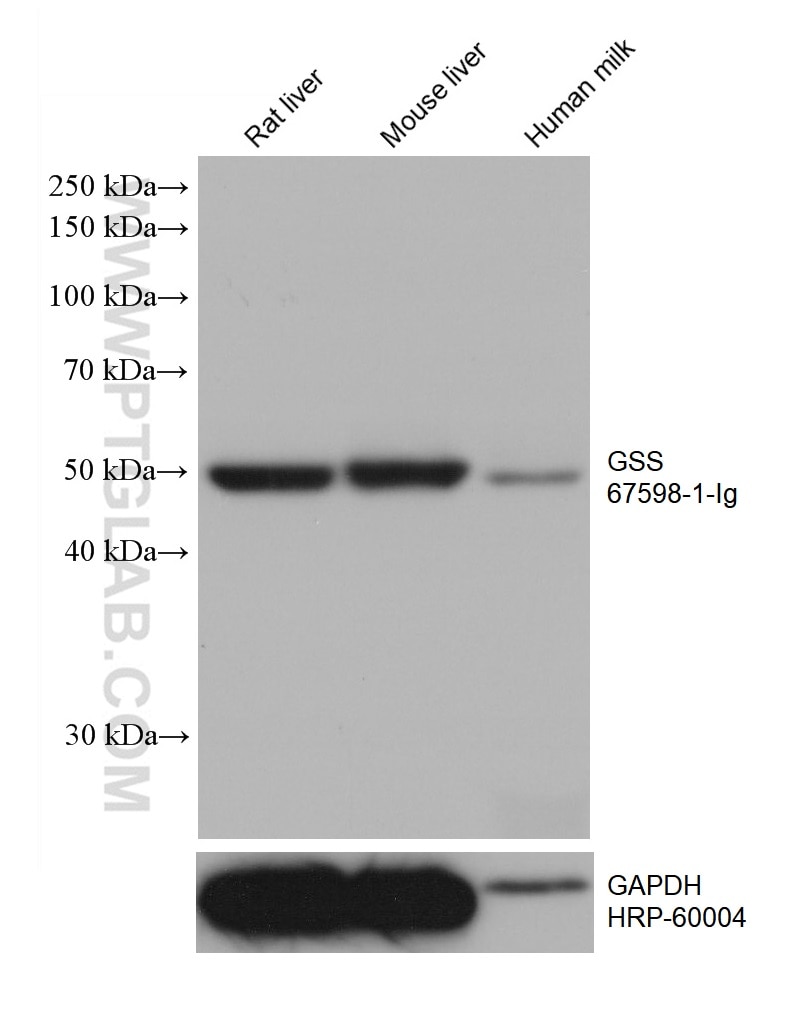 Western Blot (WB) analysis of various lysates using GSS Monoclonal antibody (67598-1-Ig)