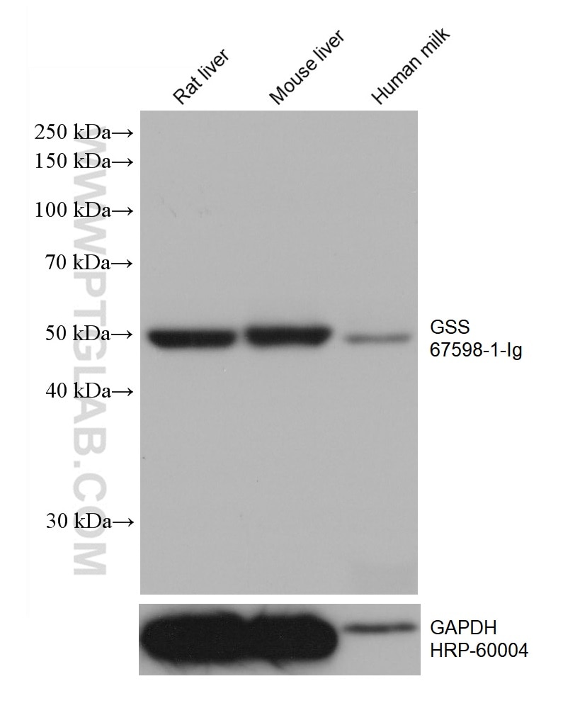 WB analysis using 67598-1-Ig