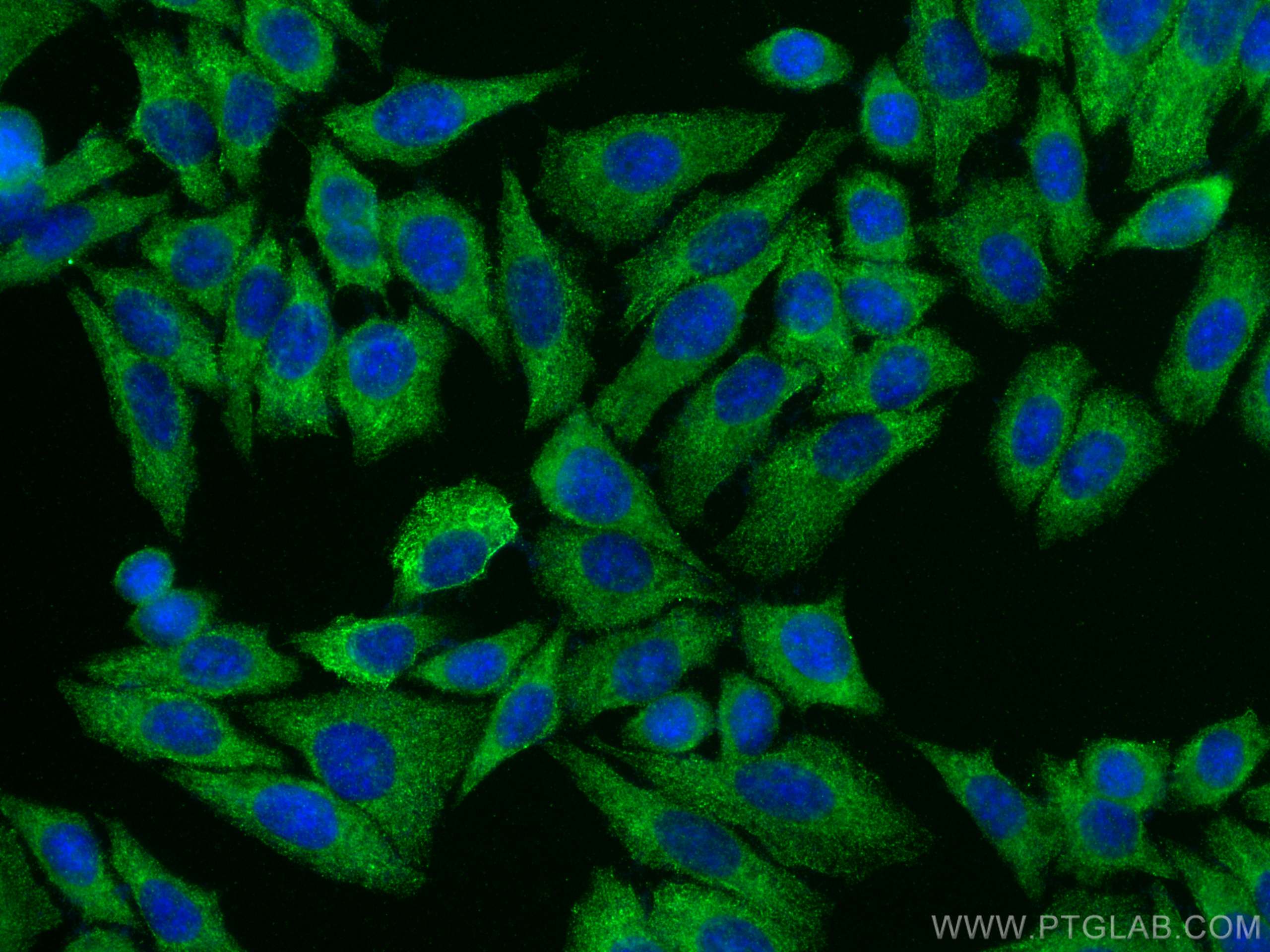 Immunofluorescence (IF) / fluorescent staining of HepG2 cells using GSTA1 Polyclonal antibody (14475-1-AP)