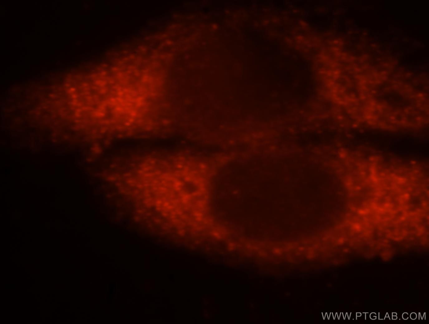 Immunofluorescence (IF) / fluorescent staining of HepG2 cells using GSTA1 Polyclonal antibody (14475-1-AP)