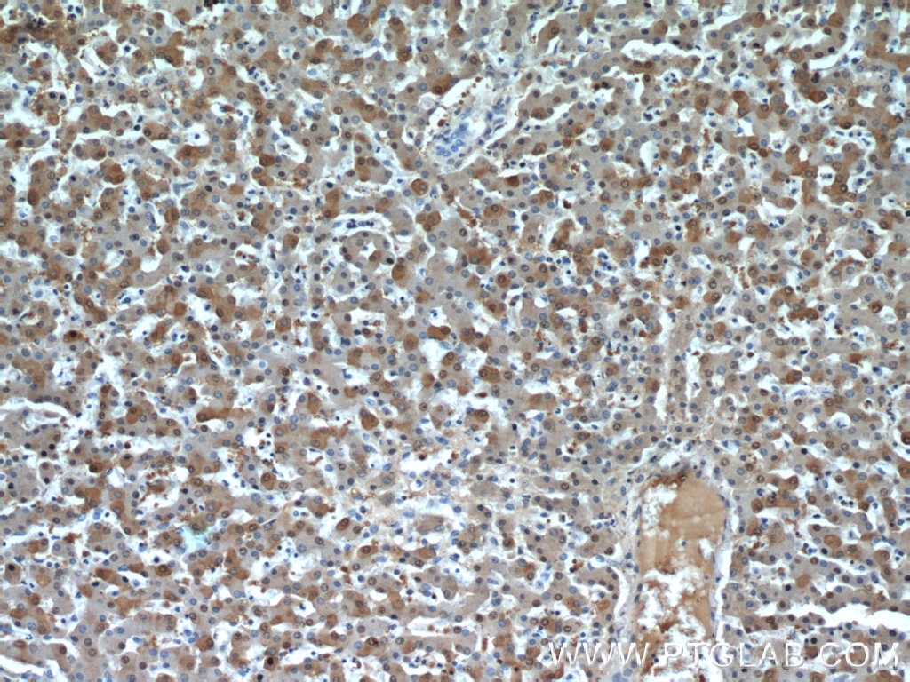 Immunohistochemistry (IHC) staining of human liver tissue using GSTA1 Polyclonal antibody (14475-1-AP)