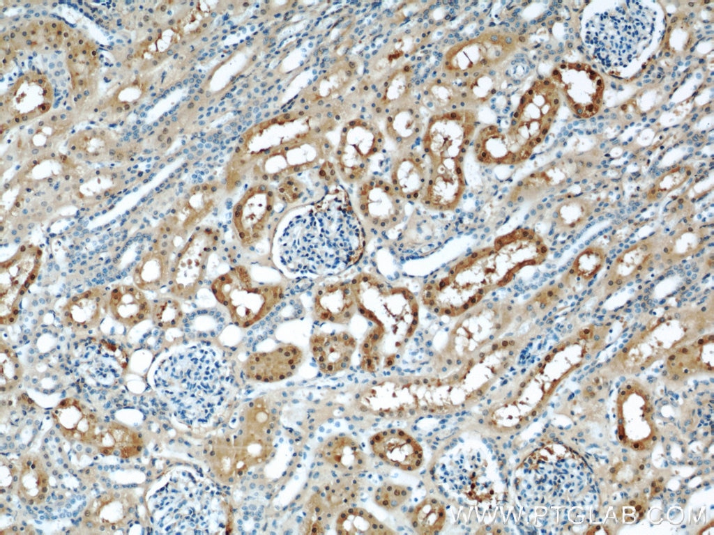 IHC staining of human kidney using 14475-1-AP