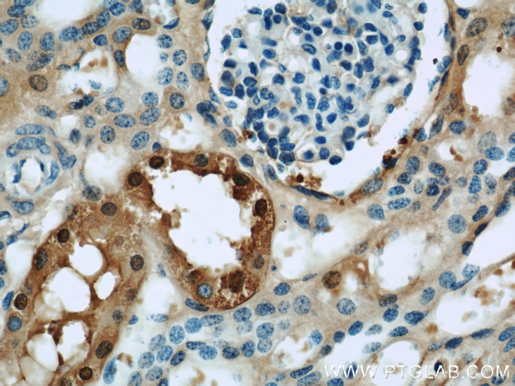 Immunohistochemistry (IHC) staining of human kidney tissue using GSTA1 Polyclonal antibody (14475-1-AP)