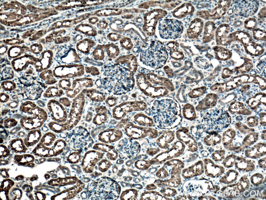 Immunohistochemistry (IHC) staining of human kidney tissue using GSTA1 Monoclonal antibody (66624-1-Ig)