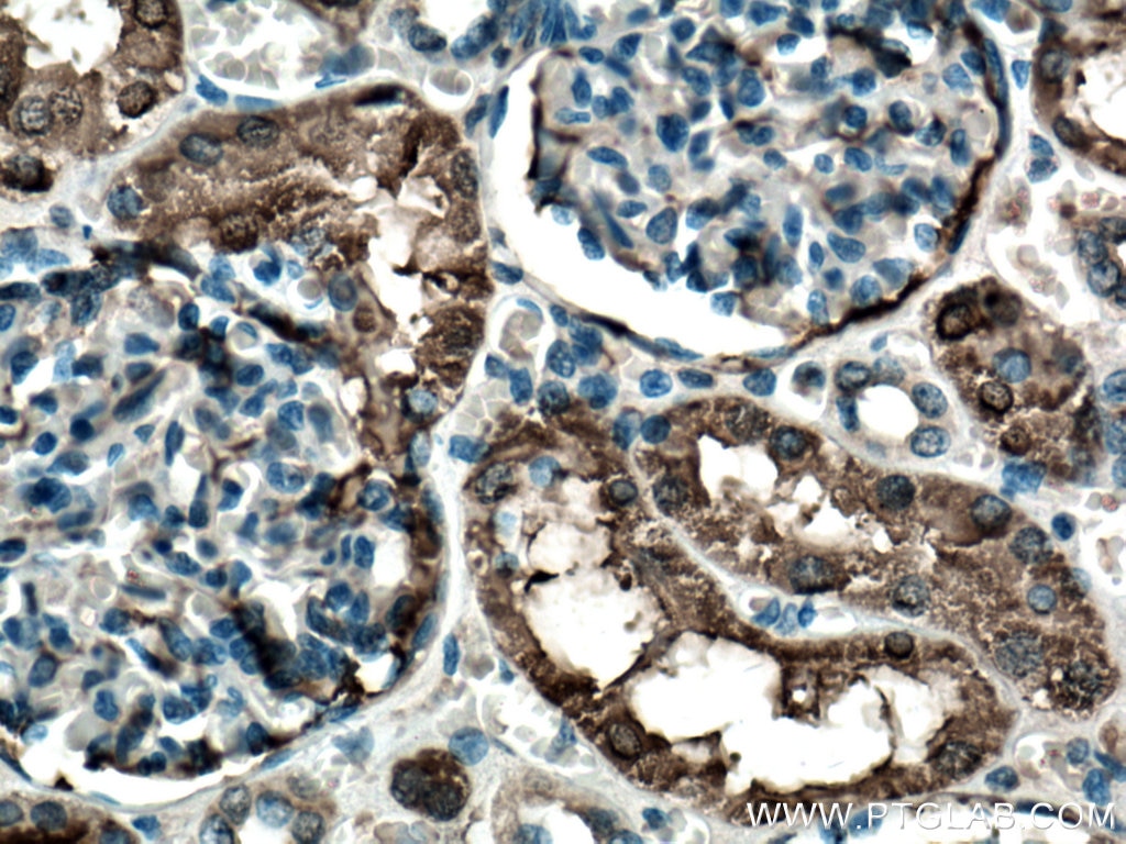 Immunohistochemistry (IHC) staining of human kidney tissue using GSTA1 Monoclonal antibody (66624-1-Ig)