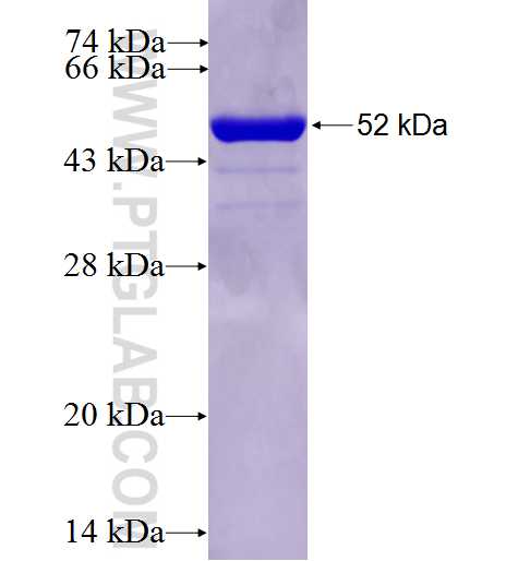 GSTA1 fusion protein Ag5849 SDS-PAGE