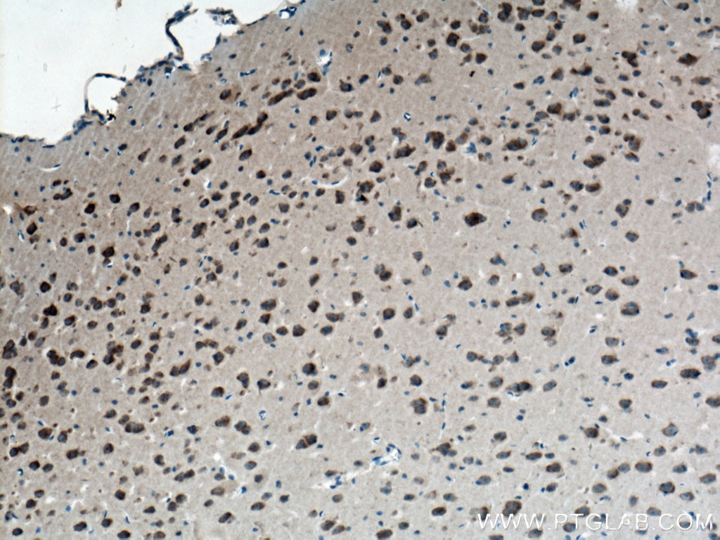 Immunohistochemistry (IHC) staining of mouse brain tissue using GSTA2 Polyclonal antibody (10505-1-AP)