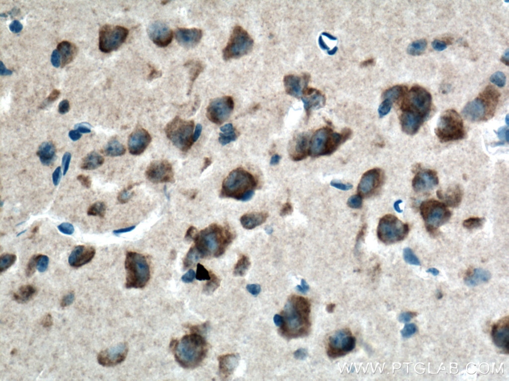 Immunohistochemistry (IHC) staining of mouse brain tissue using GSTA2 Polyclonal antibody (10505-1-AP)