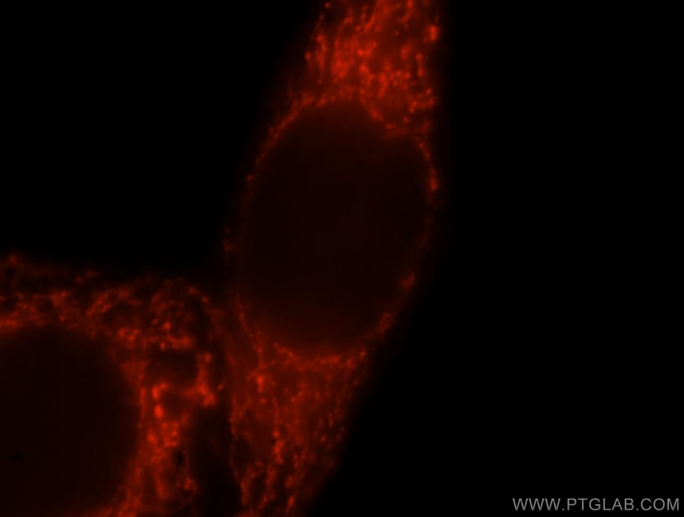 Immunofluorescence (IF) / fluorescent staining of MCF-7 cells using GSTA3 Polyclonal antibody (16703-1-AP)