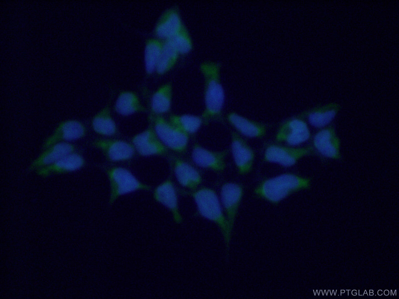 Immunofluorescence (IF) / fluorescent staining of HEK-293 cells using GSTA4 Polyclonal antibody (17271-1-AP)