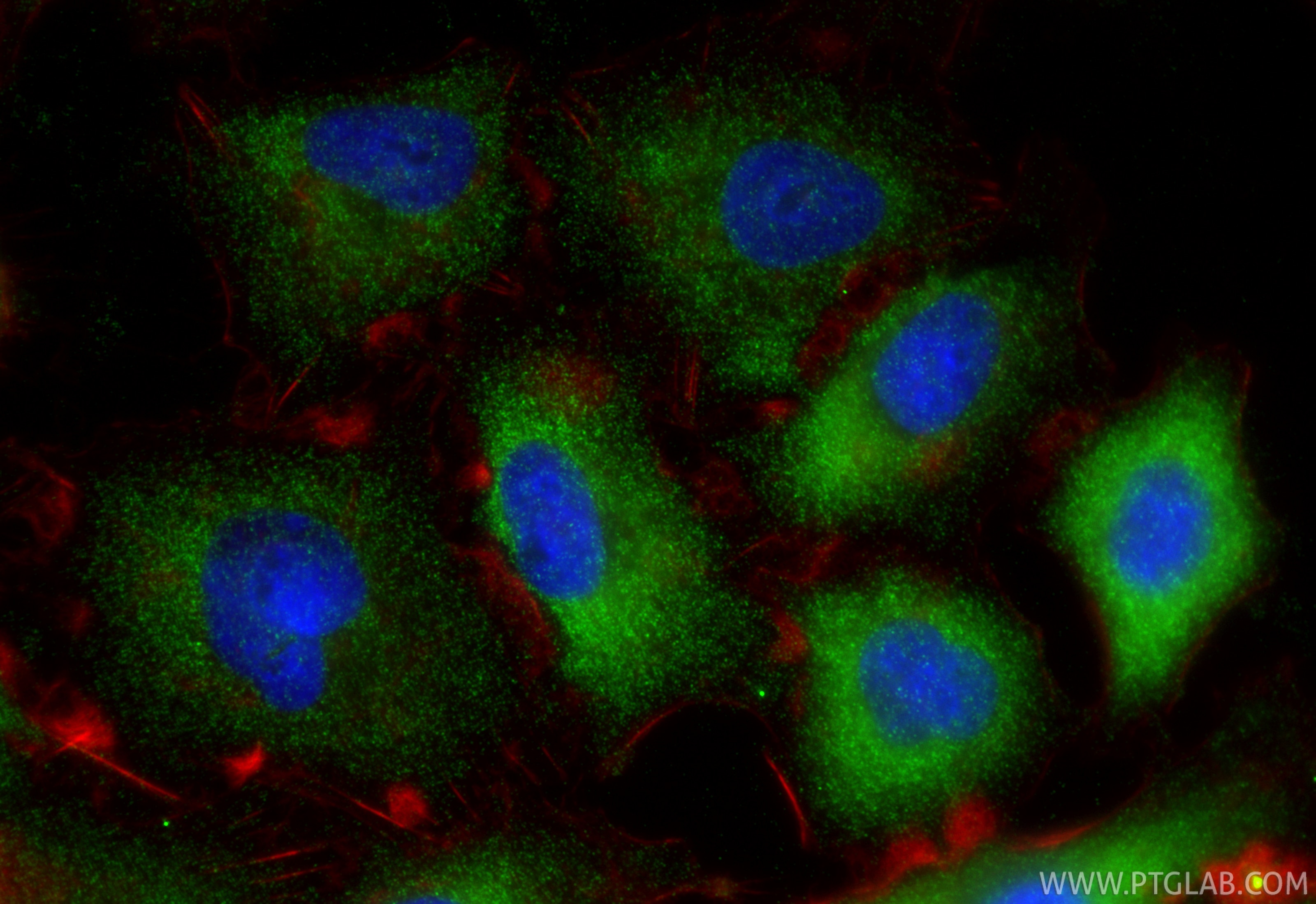 Immunofluorescence (IF) / fluorescent staining of A549 cells using GSTA4 Polyclonal antibody (17271-1-AP)