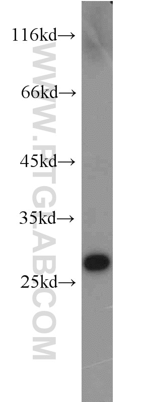 Western Blot (WB) analysis of human brain tissue using GSTA4 Polyclonal antibody (17271-1-AP)