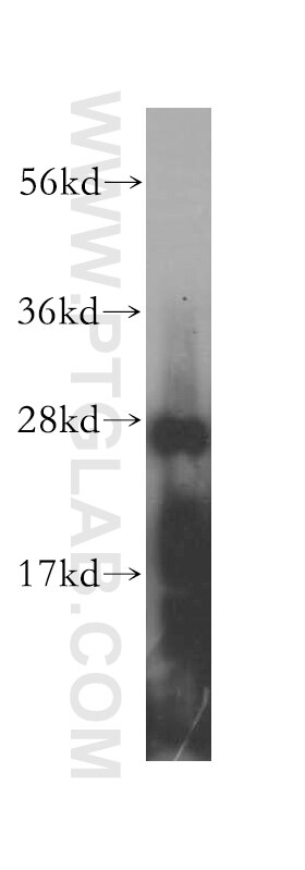 Western Blot (WB) analysis of human brain tissue using GSTA4 Polyclonal antibody (17271-1-AP)