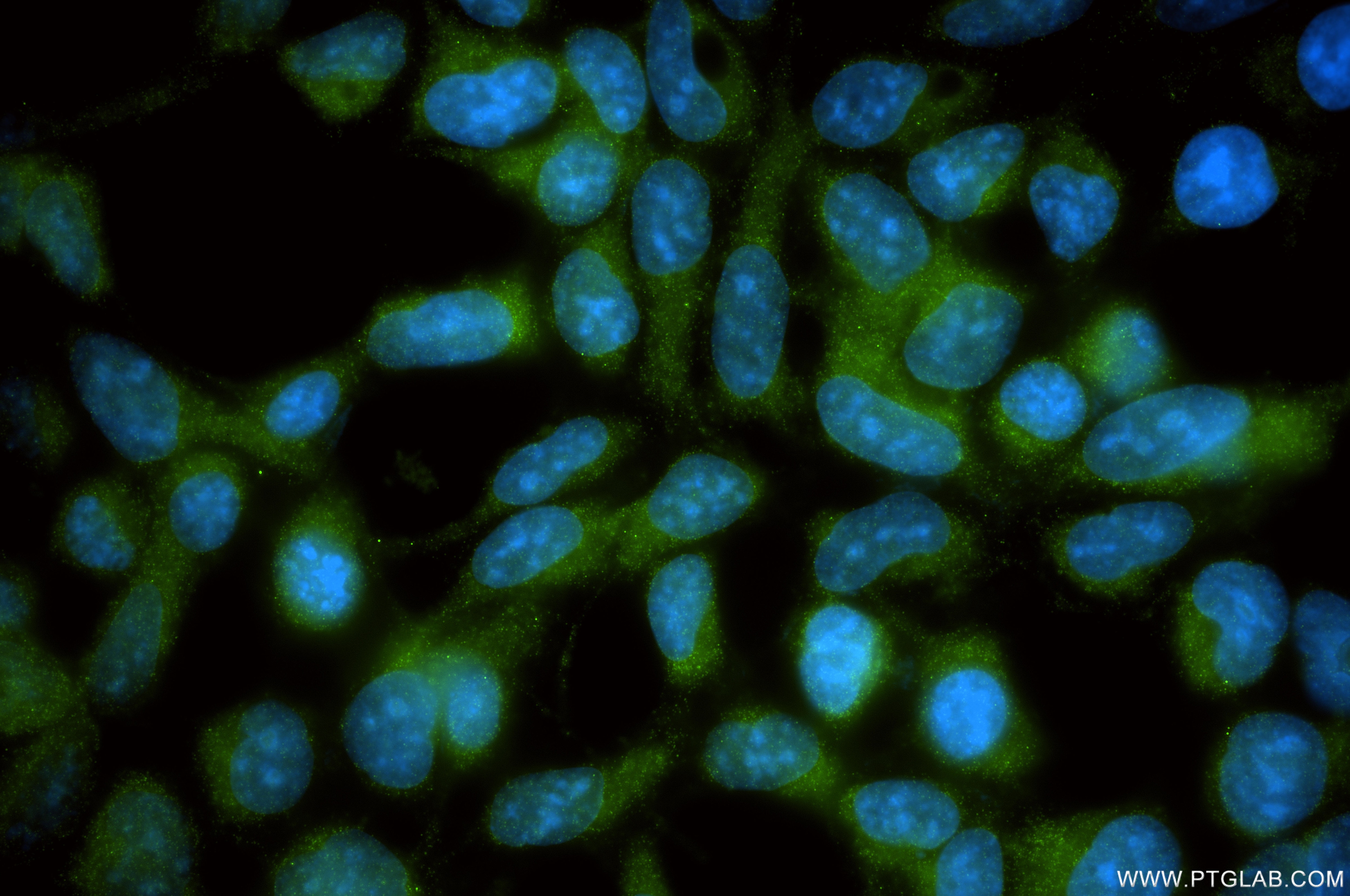 Immunofluorescence (IF) / fluorescent staining of HEK-293 cells using GSTA4 Recombinant monoclonal antibody (85954-2-RR)