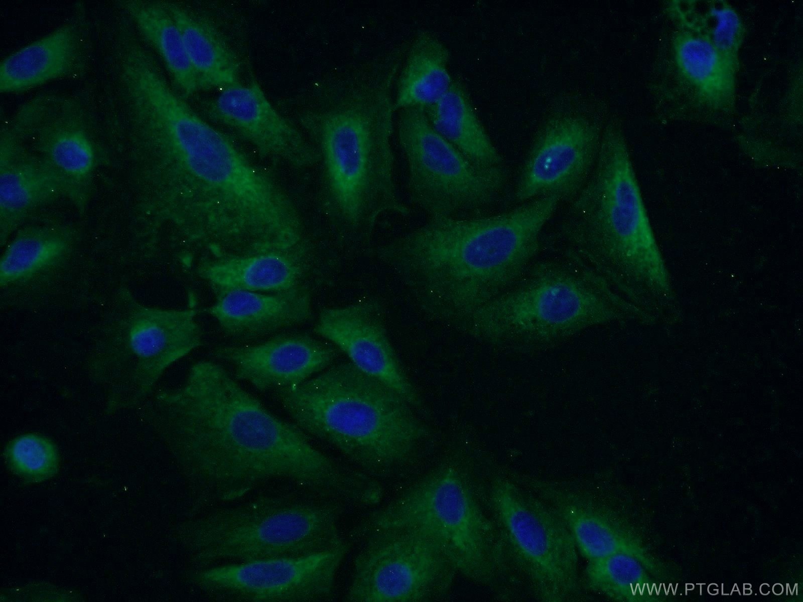 Immunofluorescence (IF) / fluorescent staining of A549 cells using GSTCD Polyclonal antibody (17502-1-AP)