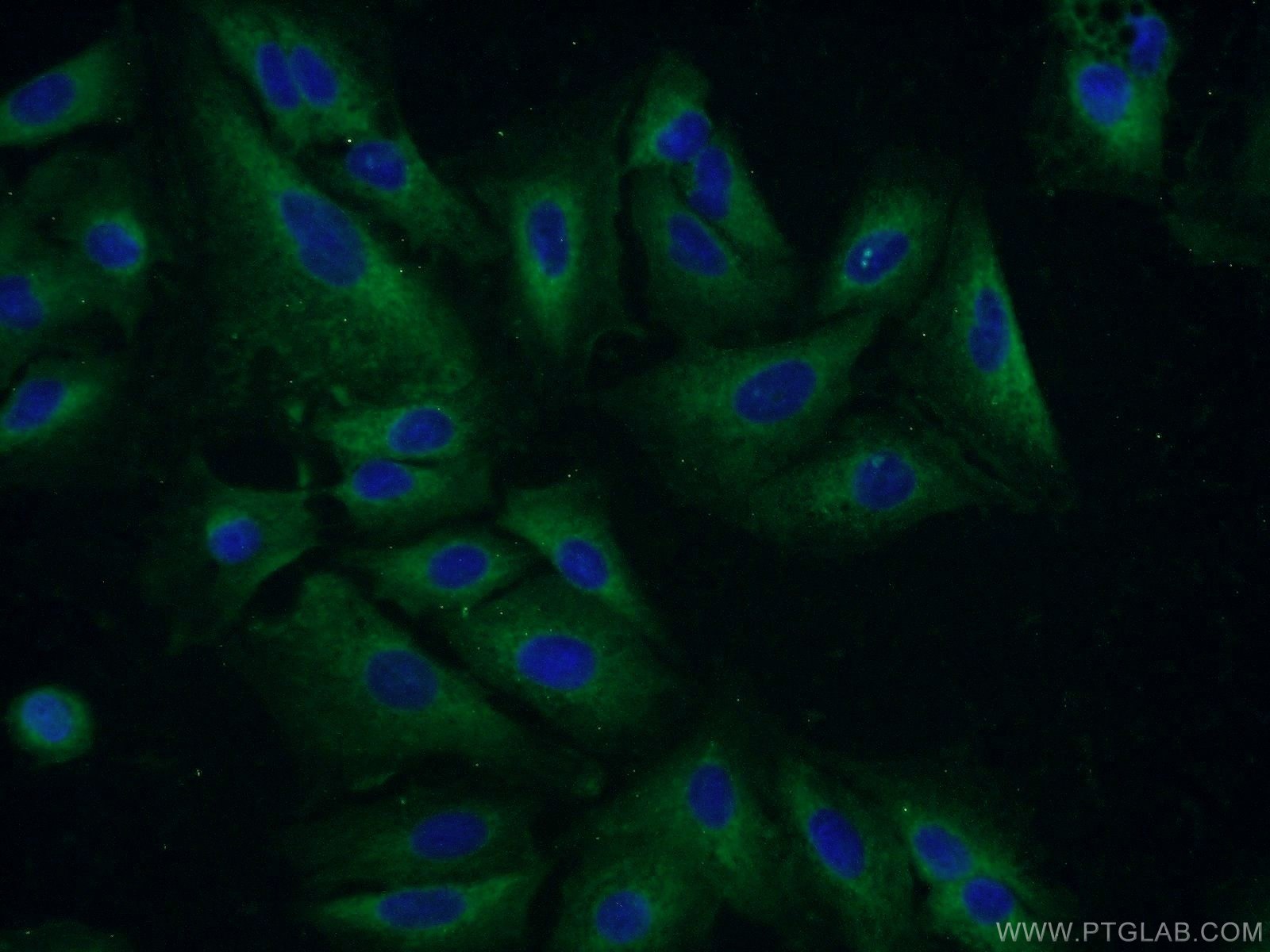 IF Staining of A549 using 17502-1-AP