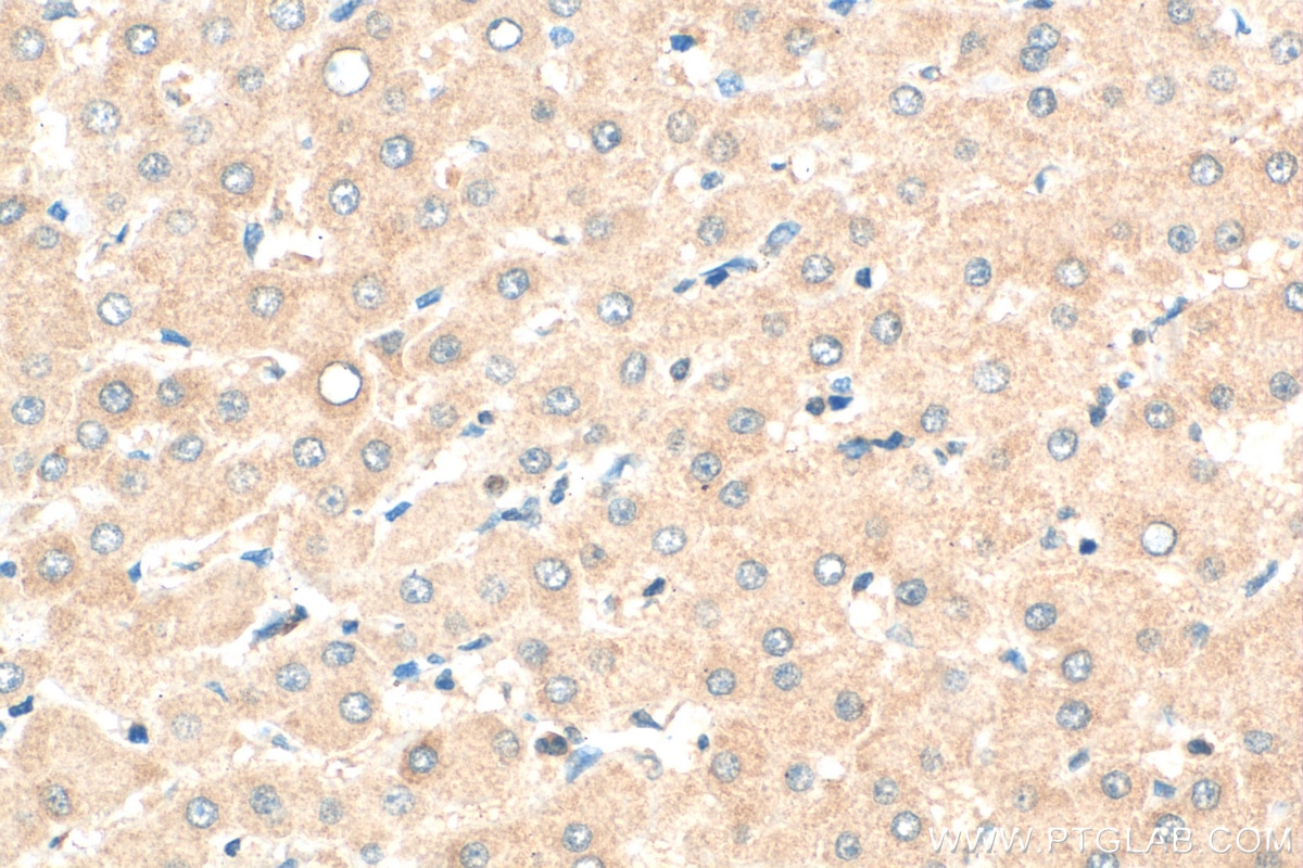 Immunohistochemistry (IHC) staining of human liver tissue using GSTCD Polyclonal antibody (17502-1-AP)