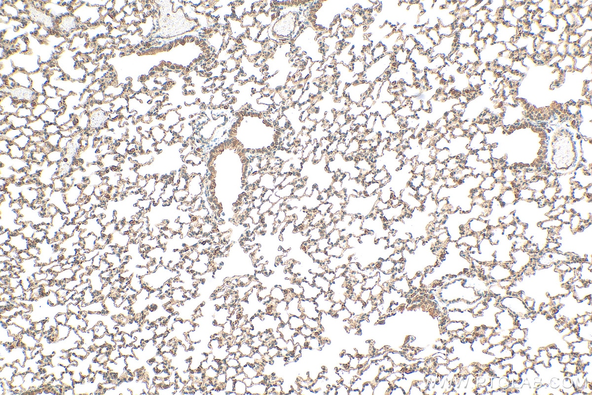IHC staining of mouse lung using 17502-1-AP