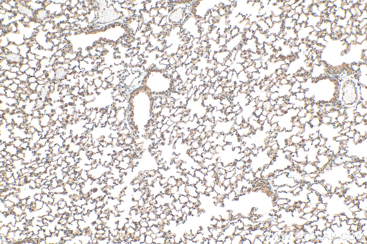 Immunohistochemistry (IHC) staining of mouse lung tissue using GSTCD Polyclonal antibody (17502-1-AP)