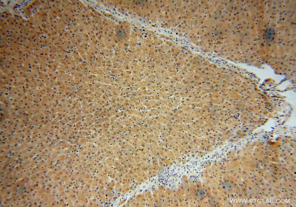 Immunohistochemistry (IHC) staining of human liver tissue using GSTCD Polyclonal antibody (17502-1-AP)